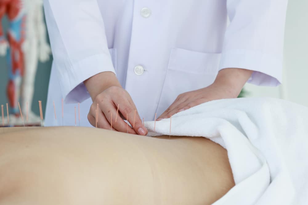 3 Tips to Help You Open and Scale Your Acupuncture Clinic